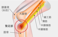 膝痛(鵞足炎) 志摩腰痛館